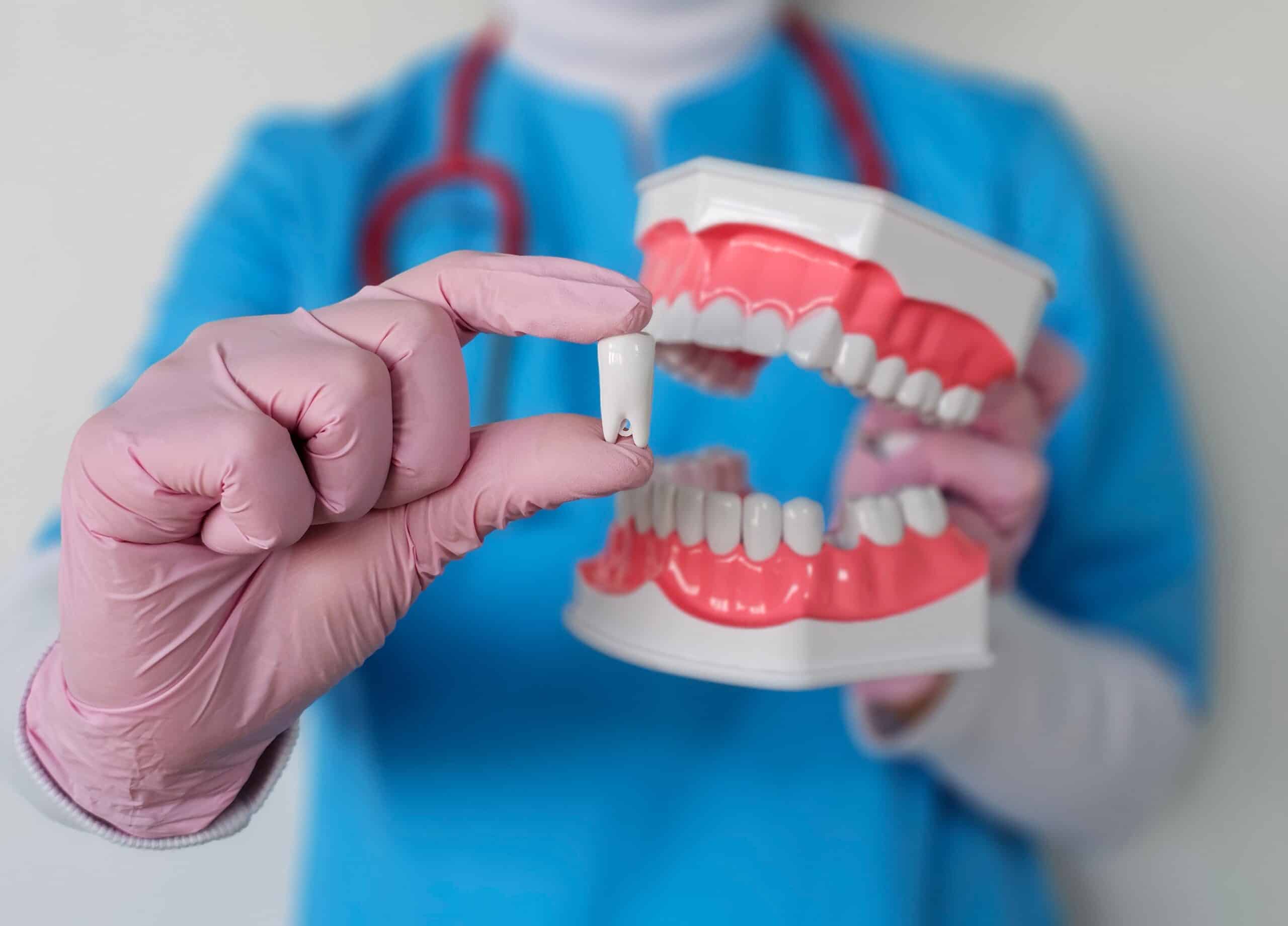 Dentist,Demonstrating,Dental,Implant,Using,Model,Teeth,In,Clinical,Environment